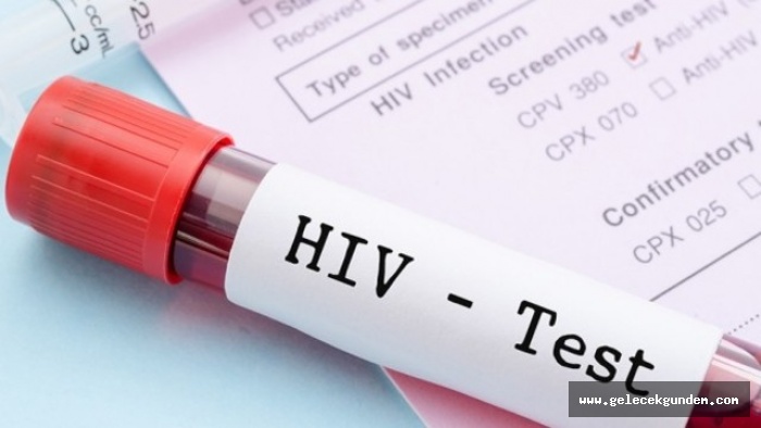 AIDS değil bilinçsizlik öldürüyor