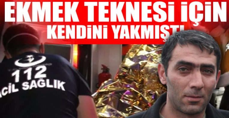 AKP'li belediye, tezgahına el koymuştu: Kendini yakan seyyar satıcı yaşam mücadelesini kaybetti
