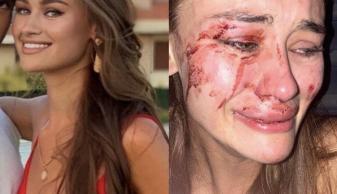 İZMİR ÇEŞME 'DEKİ ÜNLÜ MOMO BEACH CLUB 'TE DÜNYACA ÜNLÜ BAYAN MANKENE DAYAK!'