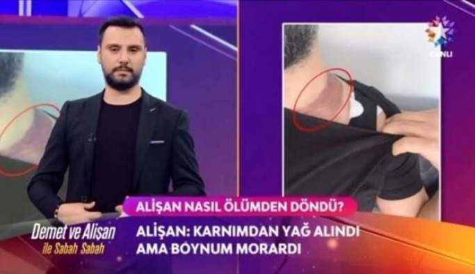 ALİŞAN'IN DAVACI OLDUĞU DR. UFUK ASKEROĞLU'NA ŞİKÂYET YAĞIYOR