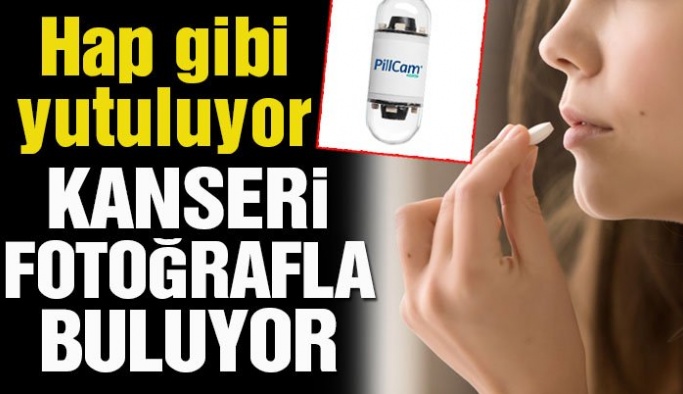 Corona teşhislere de darbe vurmuştu… Kanseri fotoğraflayarak bulacak