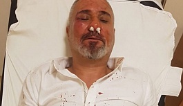 AKP'li başkan hakkında yazan gazeteciye saldırı